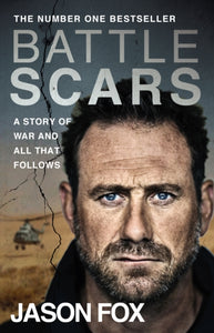 Battle Scars : A Story of War and All That Follows-9780552176019